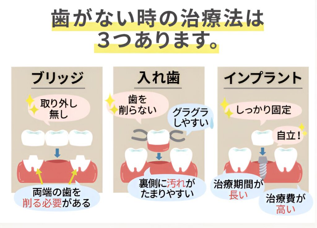 歯がなくなった場合の治療法として、主に次の3つの治療法があります。