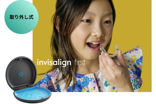 インビザラインファースト（取り外し式）